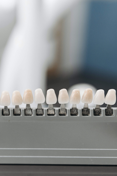 veneers